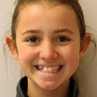 ella-case-before